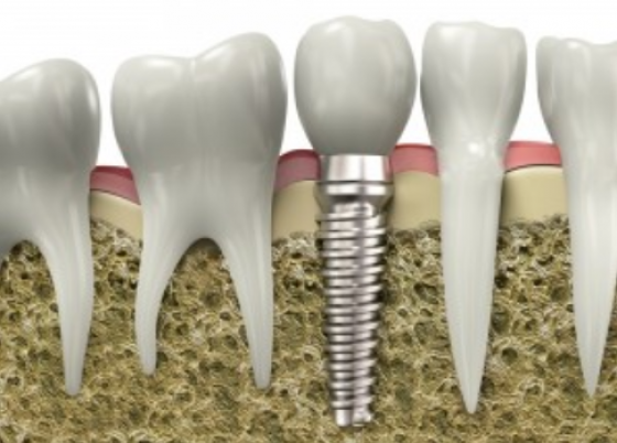 Mendelsohn Dental - dentis
