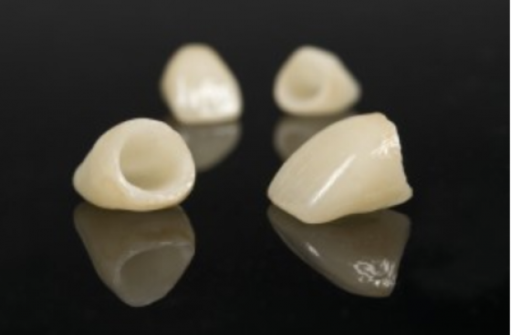 Mendelsohn Dental - dental implants