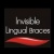 Invisible Lingual Braces Logo